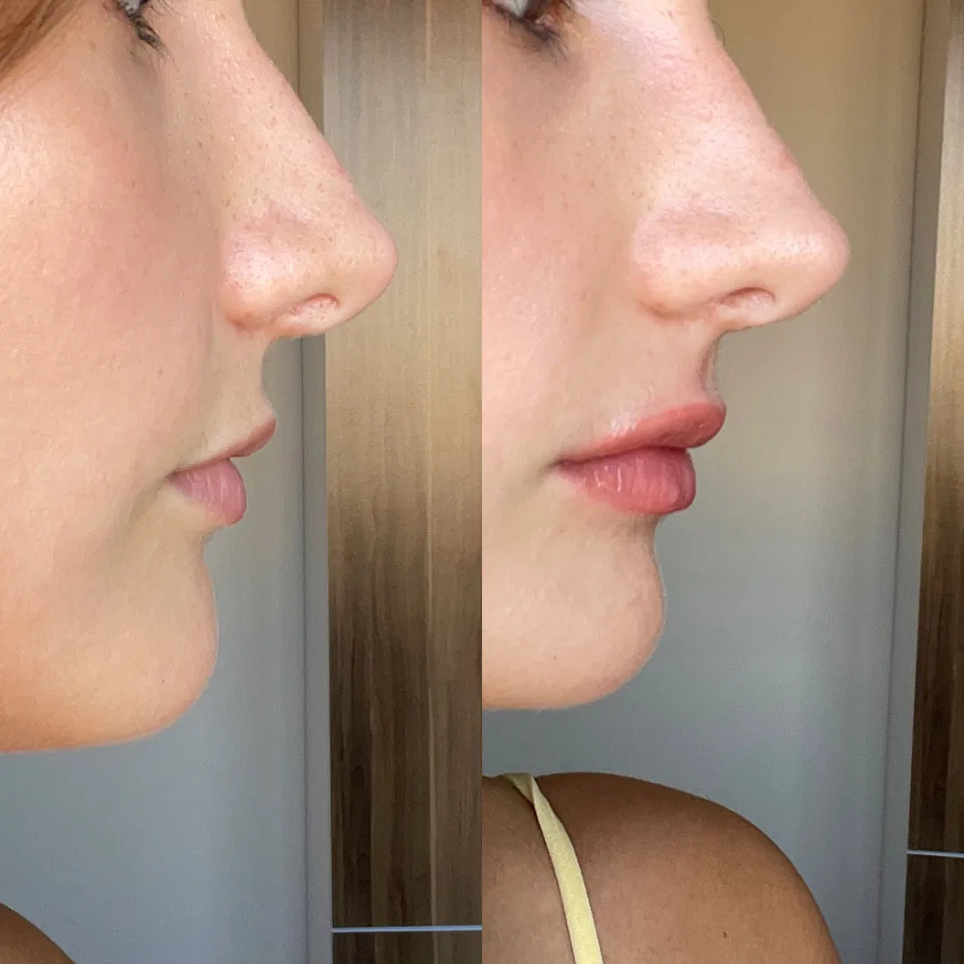 BoosterLabial + Sérum hialurónico