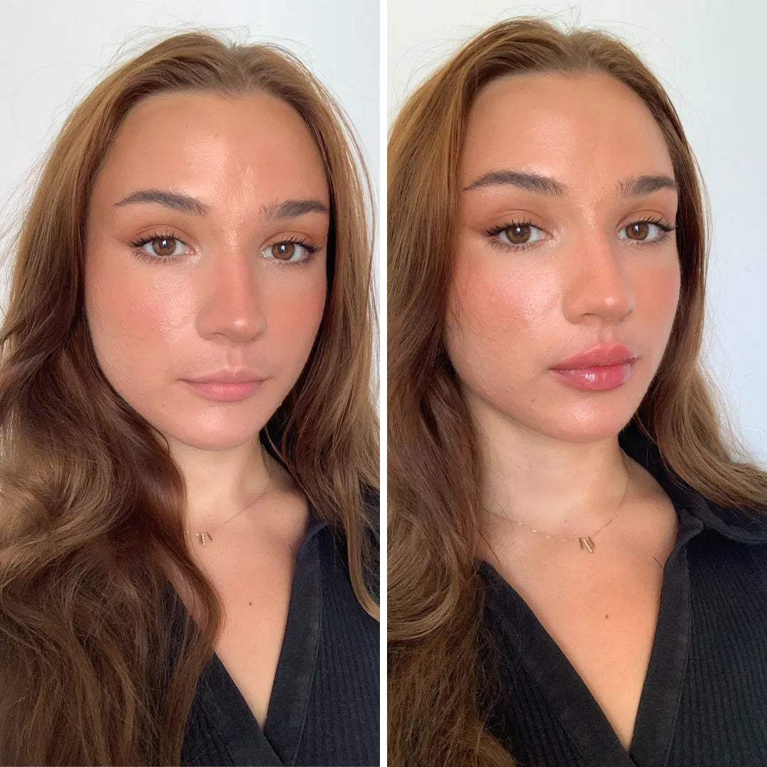 BoosterLabial + Sérum hialurónico