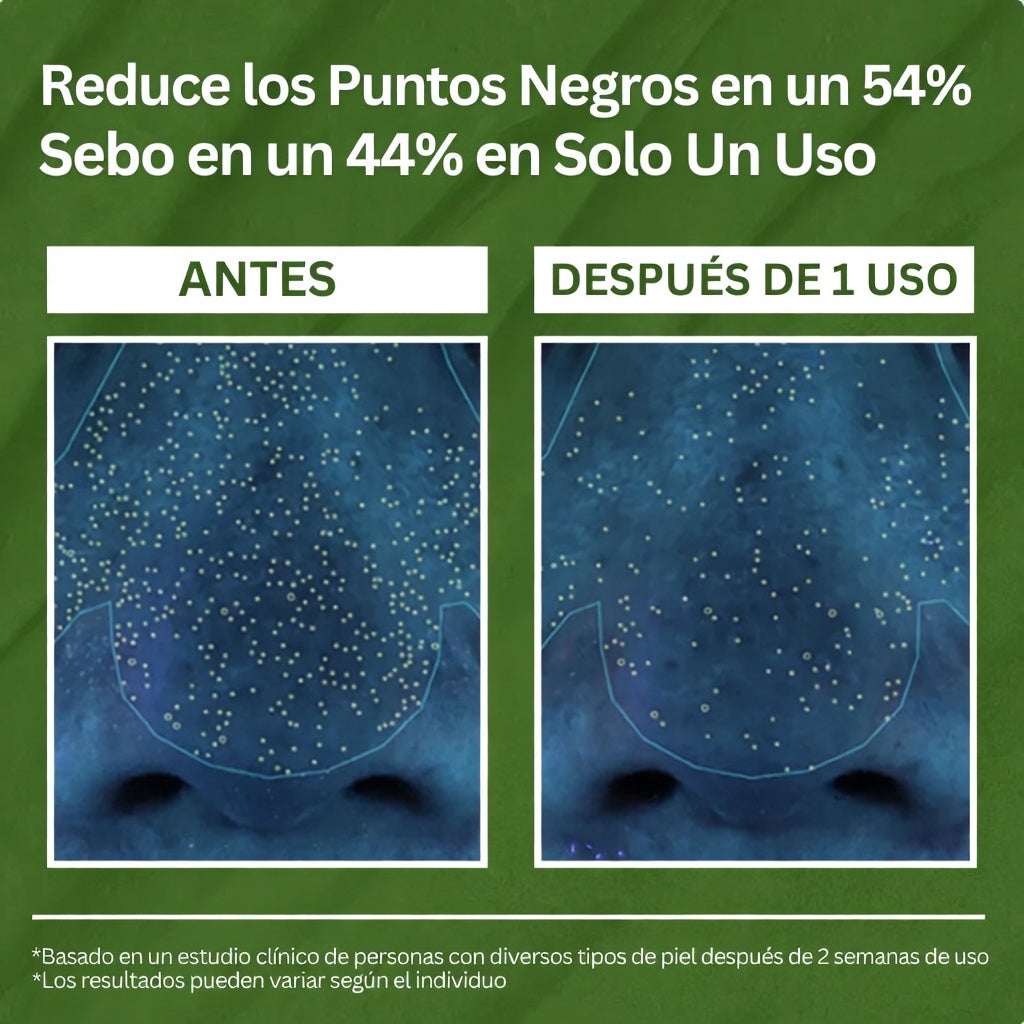 🌿 Mascarilla Basil Bubble – Limpieza Profunda & Anti Puntos Negros