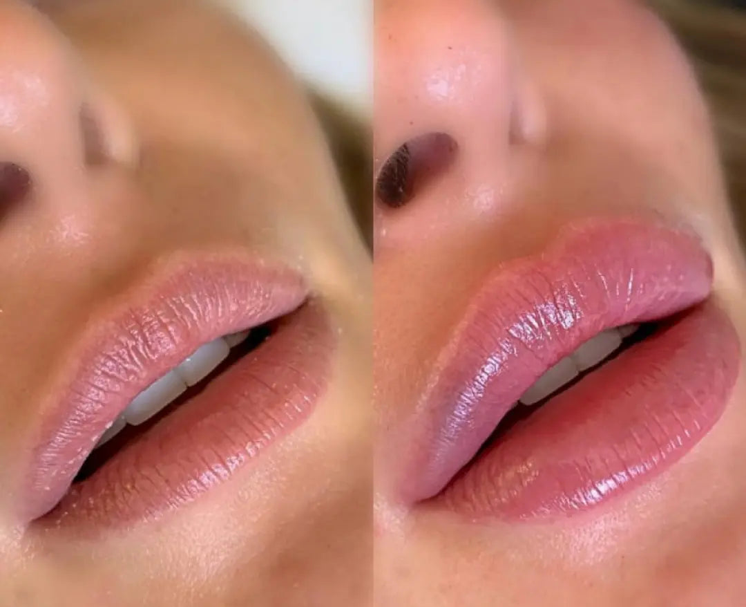 BoosterLabial + Sérum hialurónico The Ordinary™️ Mini-Mundo