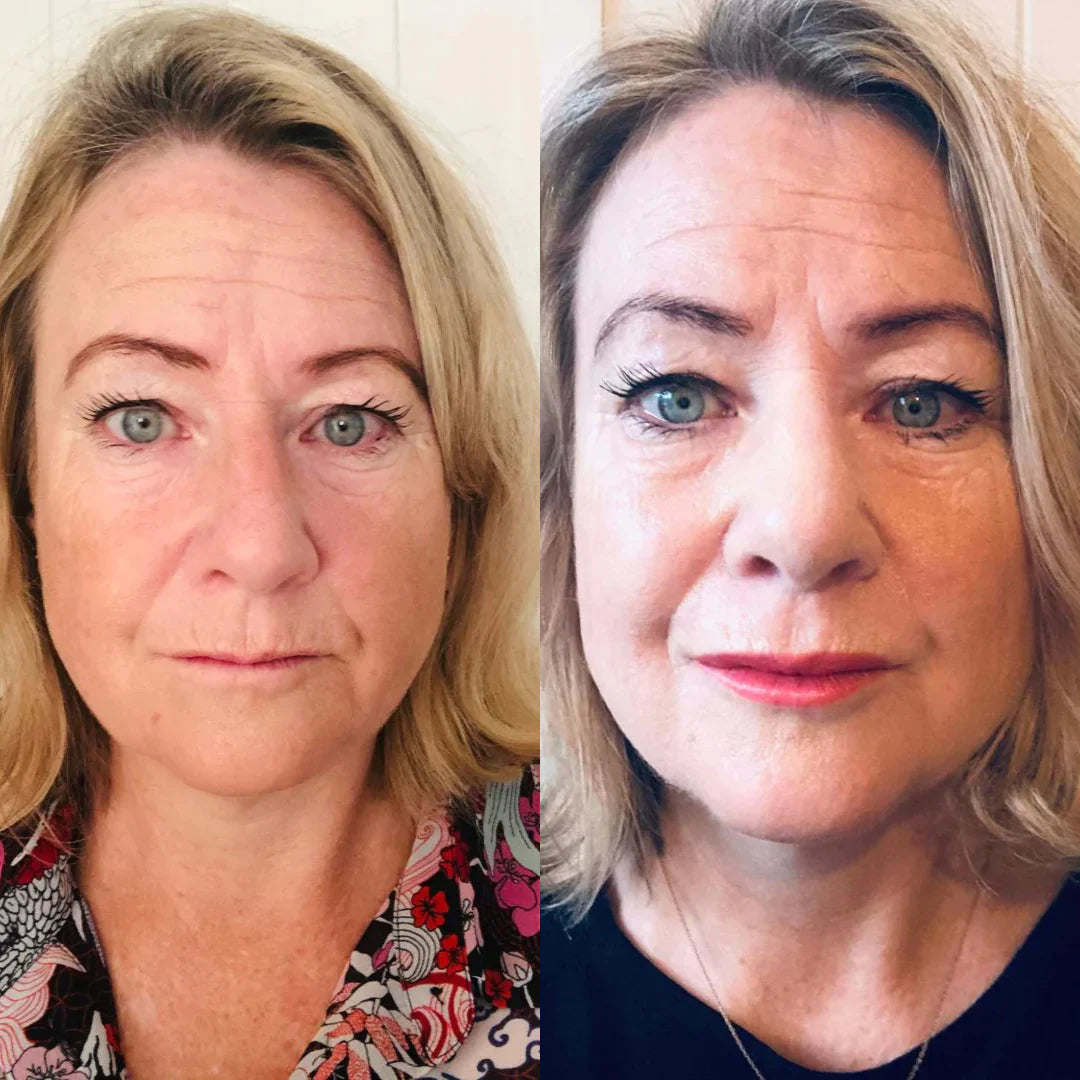 BoosterLabial + Sérum hialurónico